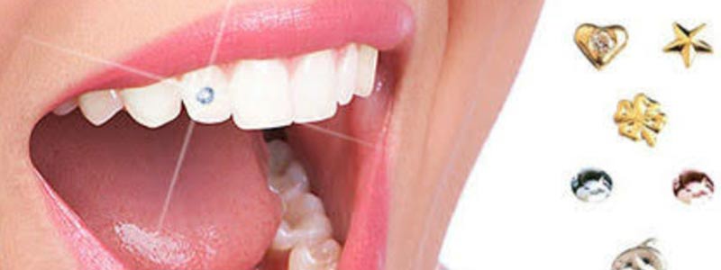Dental Tooth Jewellery